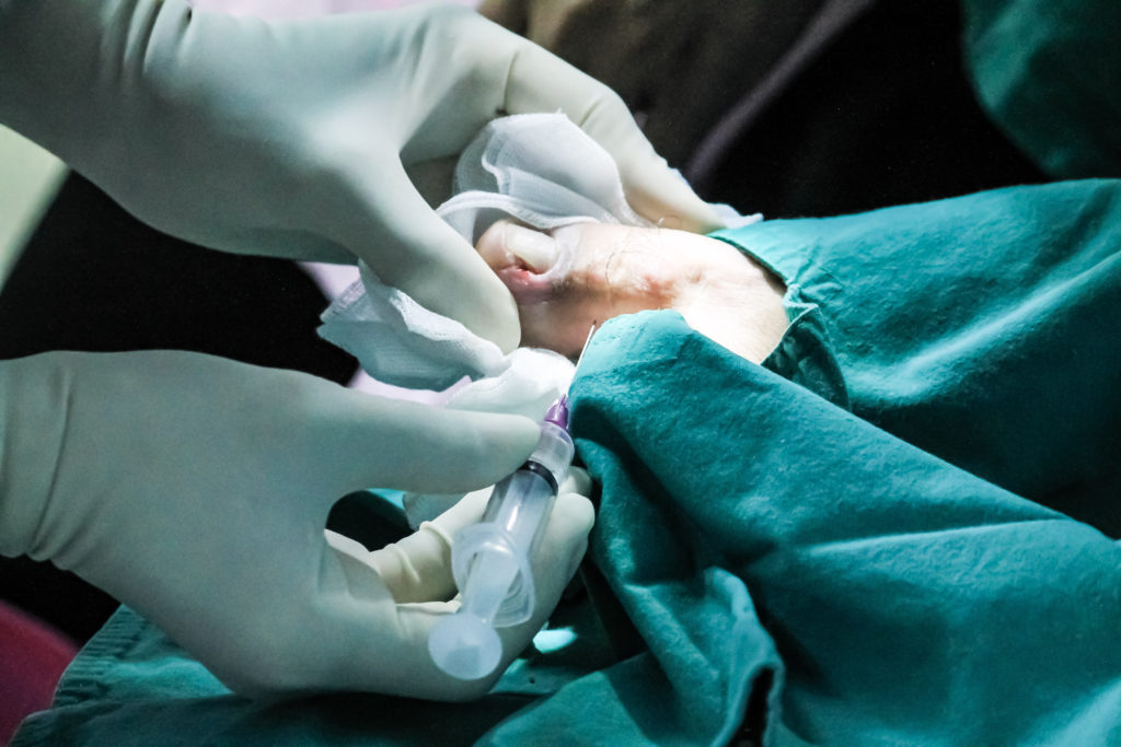 PDF) Continuing Professional Development. Nail Surgery