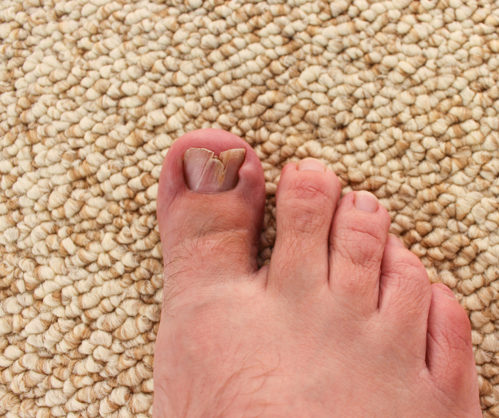 What Happens If Your Toenail Turns Green