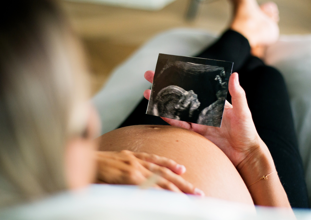 Pregnancy and Oral Health: What You Need to Know